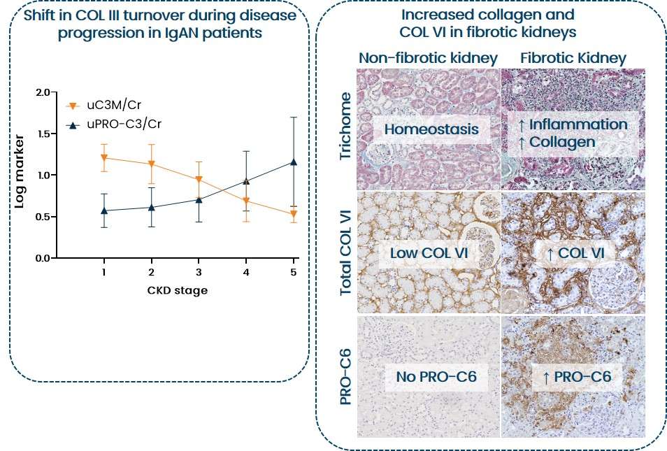 Collagen levels increase in fibrotic kidneys
