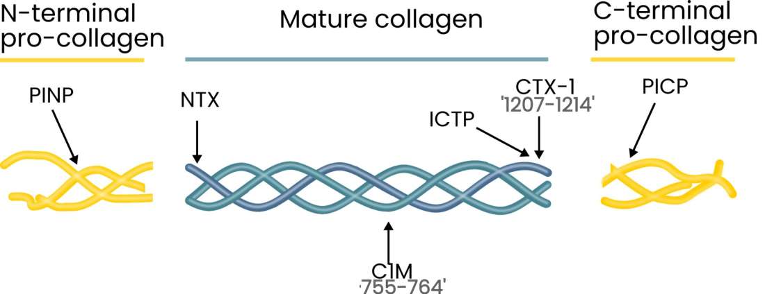 C1M is a biomarker of bone resorption for diseases in the osteology field