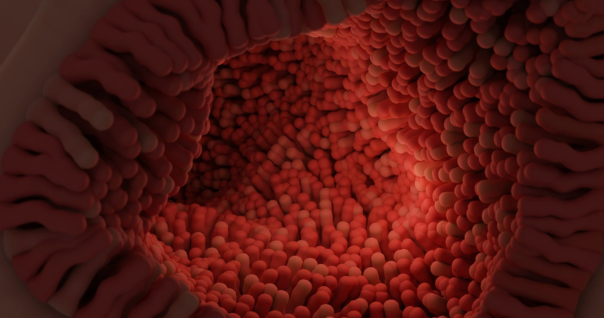 The CPa9-HNE biomarker in Crohn’s and Colitis
