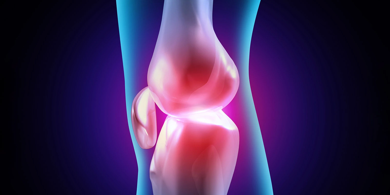 Osteoarthritis Biomarkers – Serum Quantification of Aggrecanase-Generated ARGS Fragments
