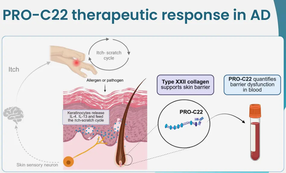Pathology and Therapeutic Response in Atopic Dermatitis